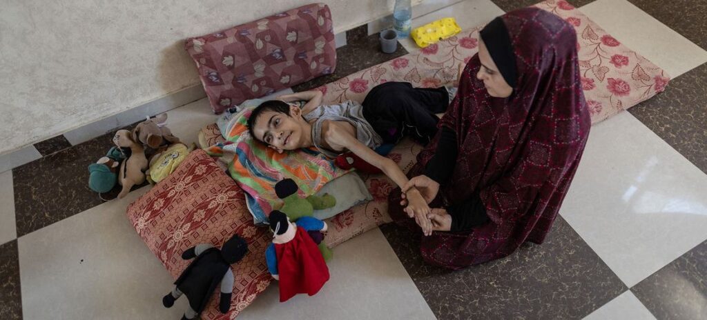 Gaza desnutrido 28Jul