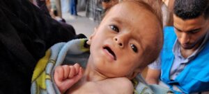 ONU Desnutridos 15Jul1